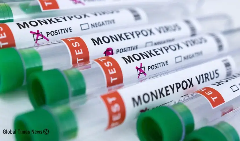 UAE reports three more monkeypox cases