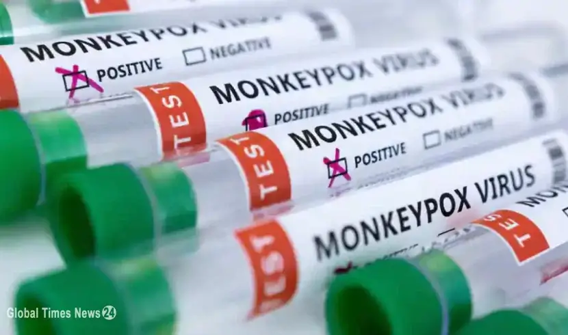 Spain reports second monkeypox-related death within 24 hours